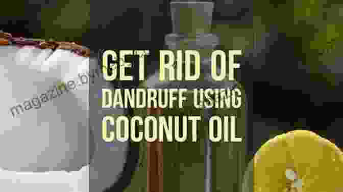 Anti Dandruff Home Remedies: Coconut Oil Anti Dandruff Home Remedies John Scalzi