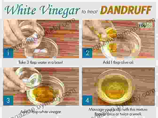 Anti Dandruff Home Remedies: Tea Tree Oil Anti Dandruff Home Remedies John Scalzi