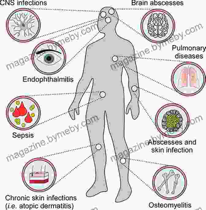 Clinical Manifestations Of Human Pathogens DDX Med Maps: Human Pathogens