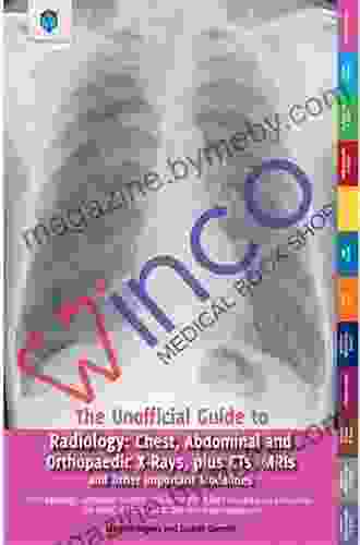 The Unofficial Guide To Radiology: Chest Abdominal Orthopaedic X Rays Plus CTs MRIs And Other Important Modalities (Unofficial Guides To Medicine)